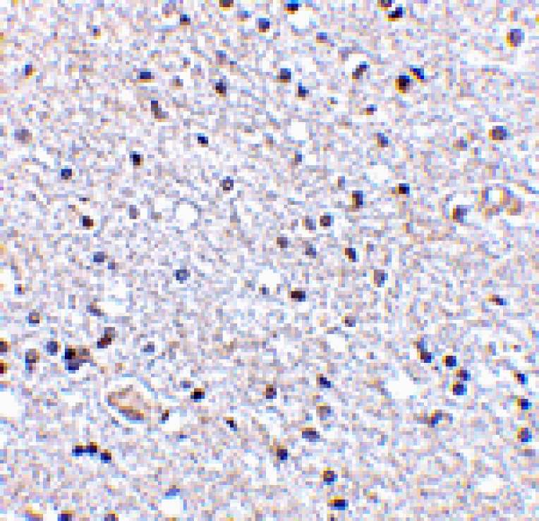 Immunohistochemistry - TSLP Antibody from Signalway Antibody (24487) - Antibodies.com