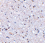 Immunohistochemistry - TSLP Antibody from Signalway Antibody (24487) - Antibodies.com