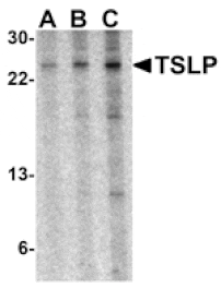 Western blot - TSLP Antibody from Signalway Antibody (24488) - Antibodies.com