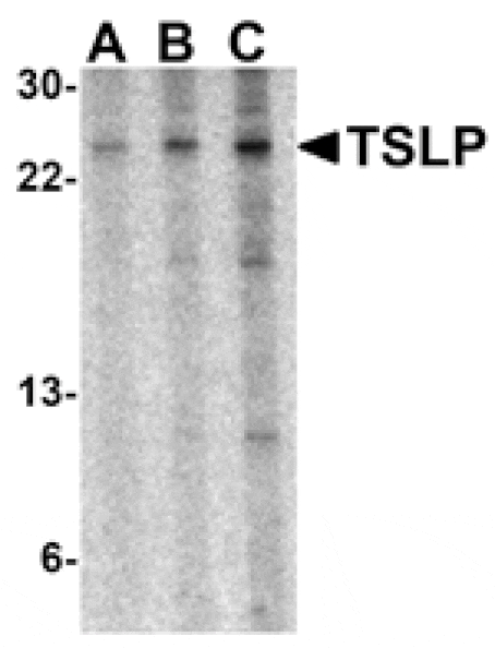 Western blot - TSLP Antibody from Signalway Antibody (24488) - Antibodies.com