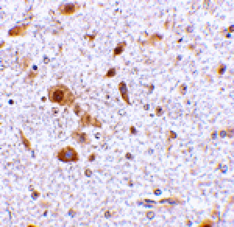 Immunohistochemistry - TSLP Antibody from Signalway Antibody (24488) - Antibodies.com