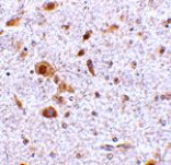 Immunohistochemistry - TSLP Antibody from Signalway Antibody (24488) - Antibodies.com