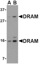 Western blot - DRAM Antibody from Signalway Antibody (24492) - Antibodies.com