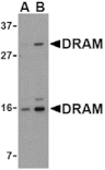 Western blot - DRAM Antibody from Signalway Antibody (24492) - Antibodies.com