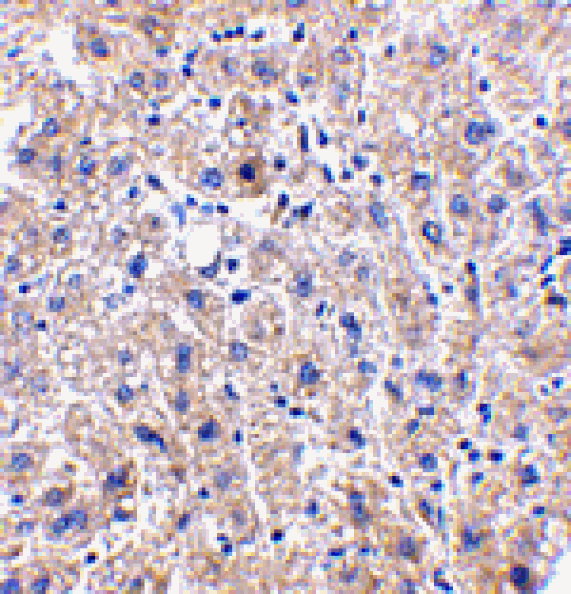 Immunohistochemistry - DRAM Antibody from Signalway Antibody (24492) - Antibodies.com