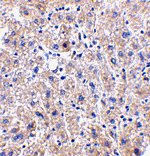 Immunohistochemistry - DRAM Antibody from Signalway Antibody (24492) - Antibodies.com