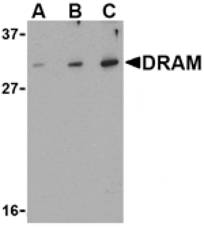 Western blot - DRAM Antibody from Signalway Antibody (24493) - Antibodies.com