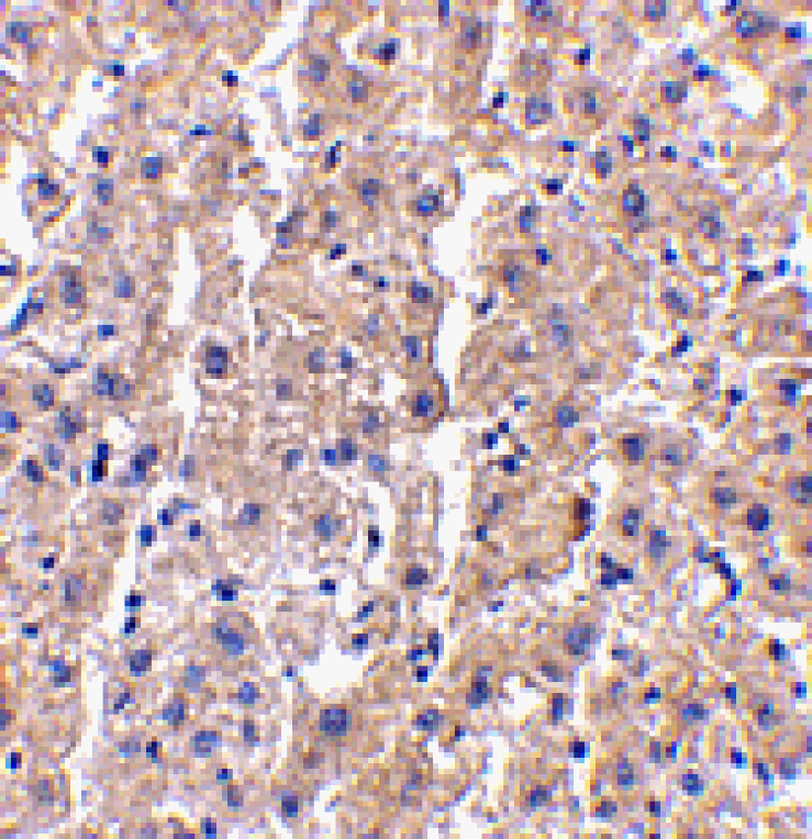 Immunohistochemistry - DRAM Antibody from Signalway Antibody (24493) - Antibodies.com