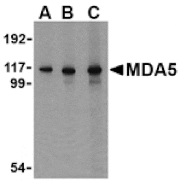 Western blot - MDA5 Antibody from Signalway Antibody (24494) - Antibodies.com