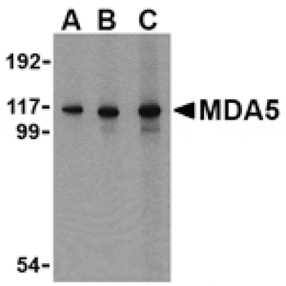 Western blot - MDA5 Antibody from Signalway Antibody (24494) - Antibodies.com