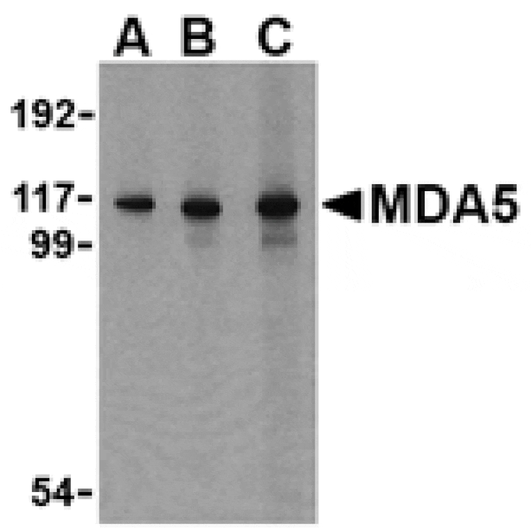 Western blot - MDA5 Antibody from Signalway Antibody (24494) - Antibodies.com
