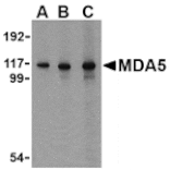 Western blot - MDA5 Antibody from Signalway Antibody (24494) - Antibodies.com