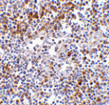 Immunohistochemistry - MDA5 Antibody from Signalway Antibody (24494) - Antibodies.com