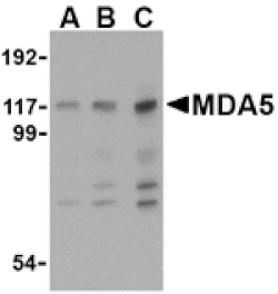 Western blot - MDA5 Antibody from Signalway Antibody (24495) - Antibodies.com