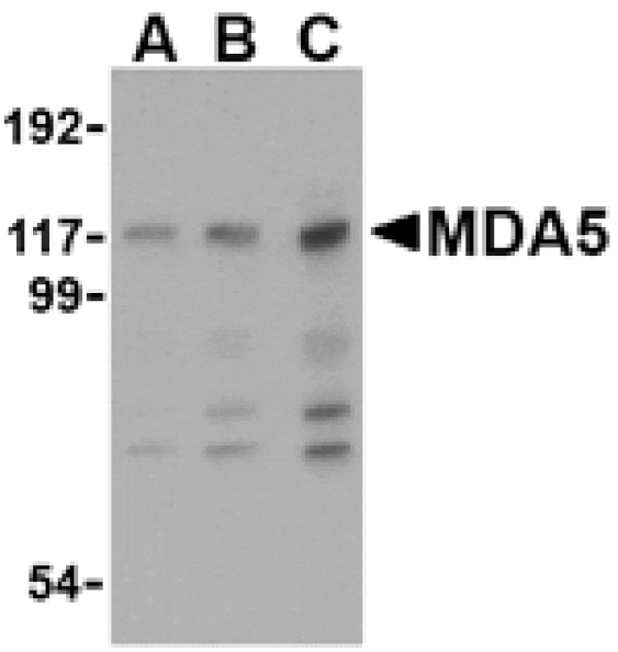 Western blot - MDA5 Antibody from Signalway Antibody (24495) - Antibodies.com