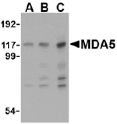Western blot - MDA5 Antibody from Signalway Antibody (24495) - Antibodies.com