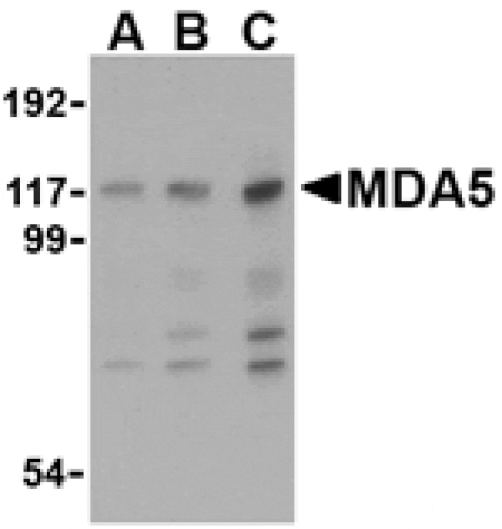Western blot - MDA5 Antibody from Signalway Antibody (24495) - Antibodies.com