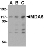 Western blot - MDA5 Antibody from Signalway Antibody (24495) - Antibodies.com