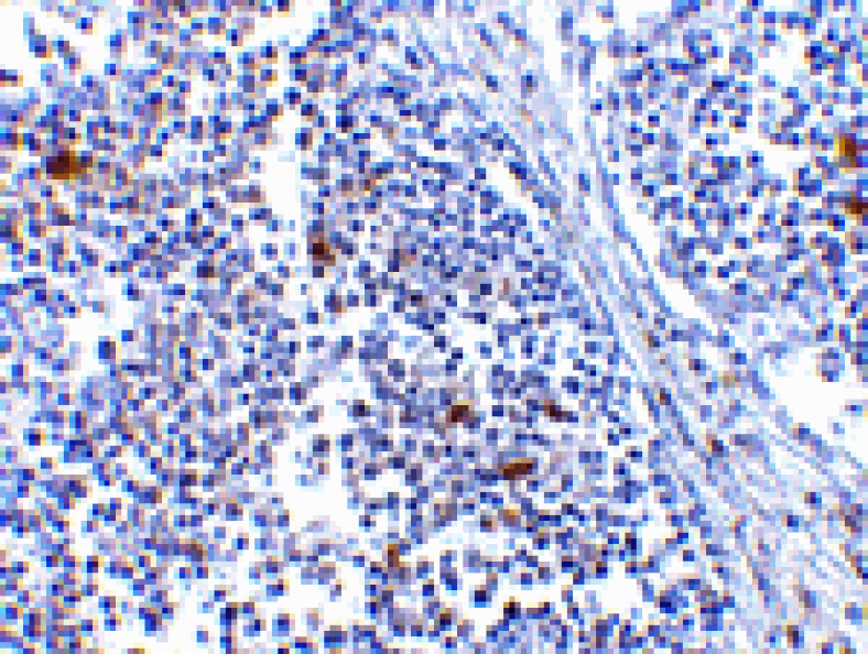 Immunohistochemistry - MDA5 Antibody from Signalway Antibody (24495) - Antibodies.com