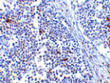 Immunohistochemistry - MDA5 Antibody from Signalway Antibody (24495) - Antibodies.com