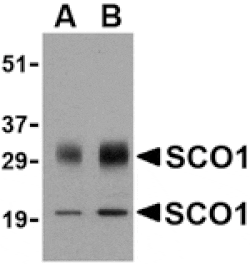 Western blot - SCO1 Antibody from Signalway Antibody (24497) - Antibodies.com