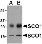 Western blot - SCO1 Antibody from Signalway Antibody (24497) - Antibodies.com