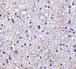 Immunohistochemistry - SCO1 Antibody from Signalway Antibody (24497) - Antibodies.com