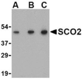 Western blot - SCO2 Antibody from Signalway Antibody (24498) - Antibodies.com
