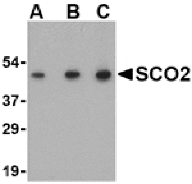 Western blot - SCO2 Antibody from Signalway Antibody (24498) - Antibodies.com