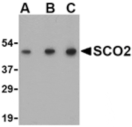 Western blot - SCO2 Antibody from Signalway Antibody (24498) - Antibodies.com