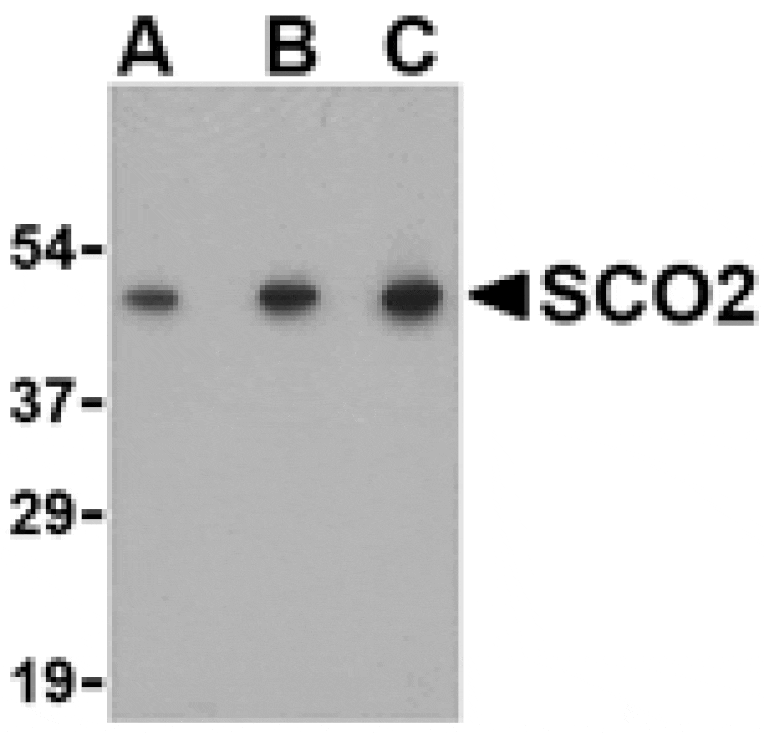 Western blot - SCO2 Antibody from Signalway Antibody (24498) - Antibodies.com