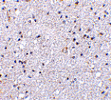 Immunohistochemistry - VISA Antibody from Signalway Antibody (24501) - Antibodies.com