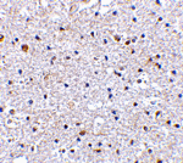 Immunohistochemistry - PD-1 Antibody from Signalway Antibody (24505) - Antibodies.com