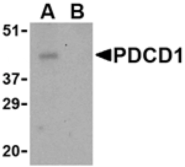 Western blot - PD-1 Antibody from Signalway Antibody (24506) - Antibodies.com