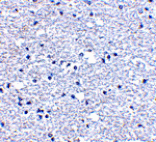 Immunohistochemistry - PD-1 Antibody from Signalway Antibody (24506) - Antibodies.com