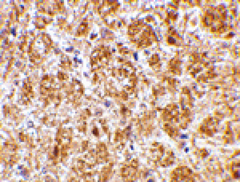 Immunohistochemistry - DARC Antibody from Signalway Antibody (24507) - Antibodies.com