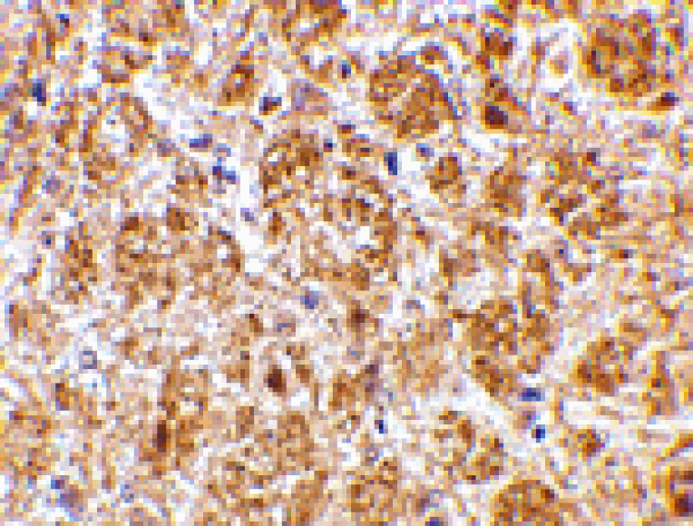 Immunohistochemistry - DARC Antibody from Signalway Antibody (24507) - Antibodies.com