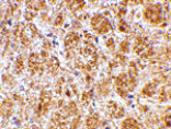 Immunohistochemistry - DARC Antibody from Signalway Antibody (24507) - Antibodies.com