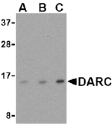 Western blot - DARC Antibody from Signalway Antibody (24508) - Antibodies.com