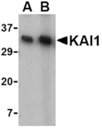 Western blot - KAI1 Antibody from Signalway Antibody (24509) - Antibodies.com