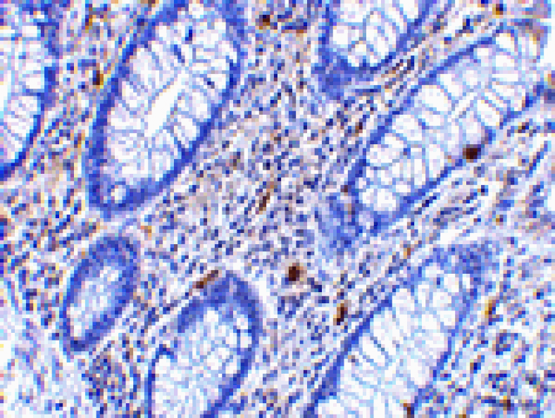 Immunohistochemistry - KAI1 Antibody from Signalway Antibody (24509) - Antibodies.com