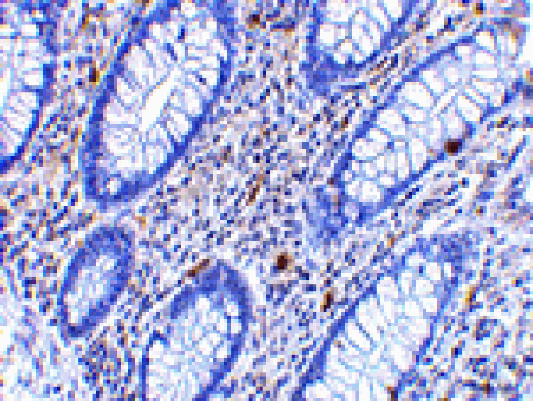 Immunohistochemistry - KAI1 Antibody from Signalway Antibody (24509) - Antibodies.com