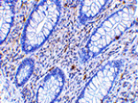 Immunohistochemistry - KAI1 Antibody from Signalway Antibody (24509) - Antibodies.com