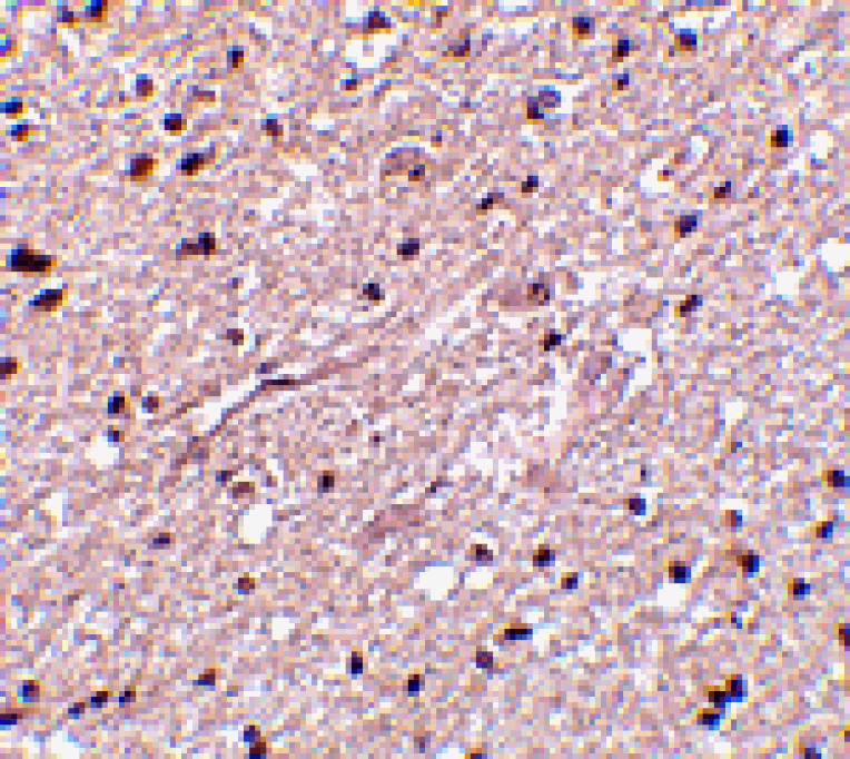 Immunohistochemistry - HAP1 Antibody from Signalway Antibody (24527) - Antibodies.com