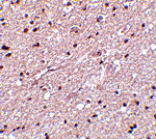 Immunohistochemistry - HAP1 Antibody from Signalway Antibody (24527) - Antibodies.com