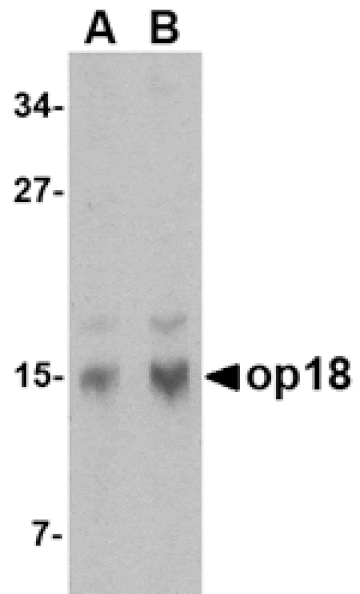 Western blot - op18 Antibody from Signalway Antibody (24538) - Antibodies.com