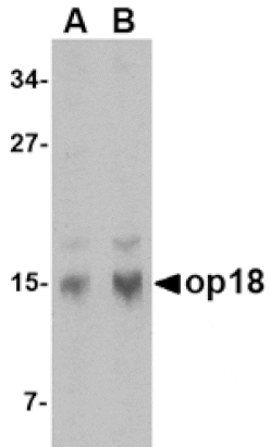 Western blot - op18 Antibody from Signalway Antibody (24538) - Antibodies.com