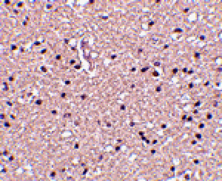 Immunohistochemistry - op18 Antibody from Signalway Antibody (24538) - Antibodies.com