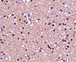 Immunohistochemistry - op18 Antibody from Signalway Antibody (24538) - Antibodies.com