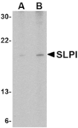 Western blot - SLPI Antibody from Signalway Antibody (24542) - Antibodies.com